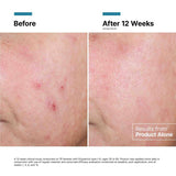 SkinCeuticals Advanced RGN-6 - 50ml