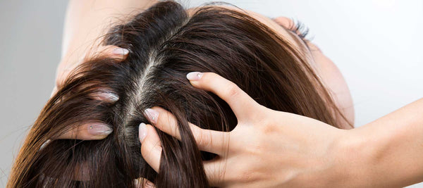 Why no summer routine should be without proper scalp care